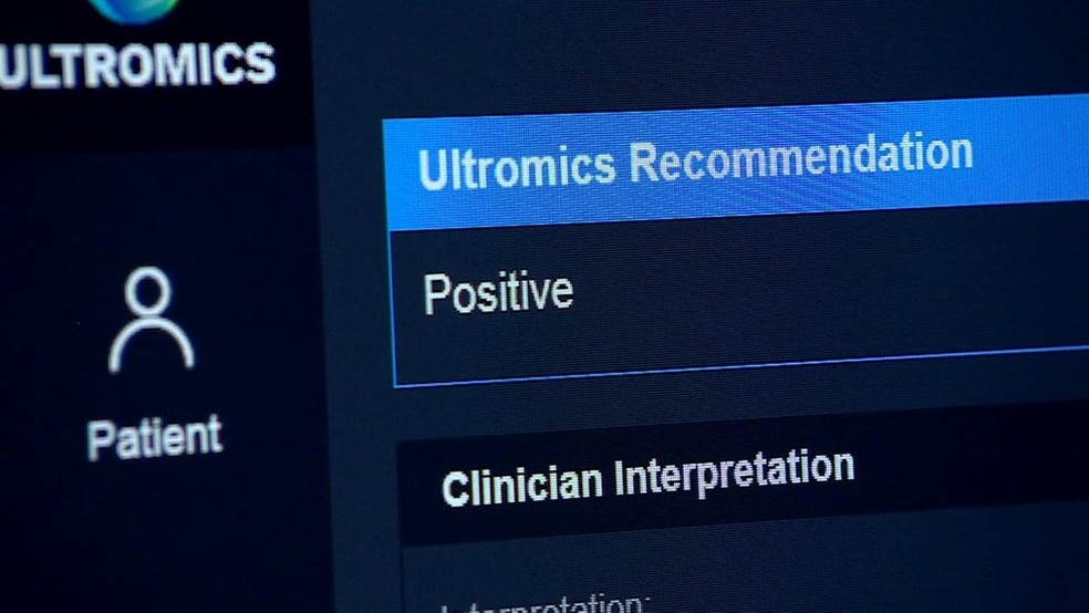 sistema-avalia-os-riscos-de-problemas-cardiacos-e-faz-recomendacoes-ao-paciente